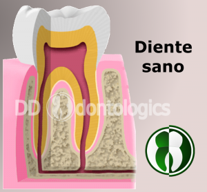 Diente Sano