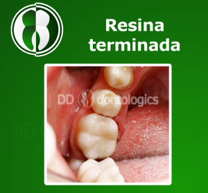 Resina terminada