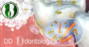 Técnica de cepillado