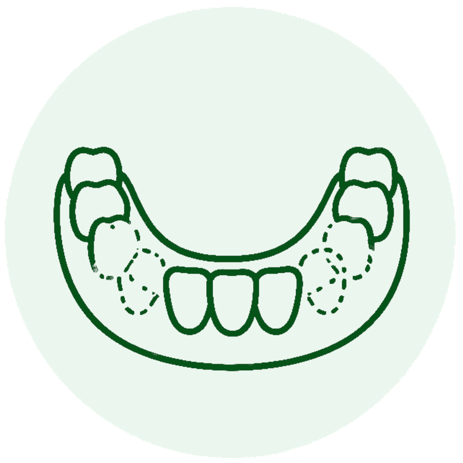 Reemplaza los dientes ausentes