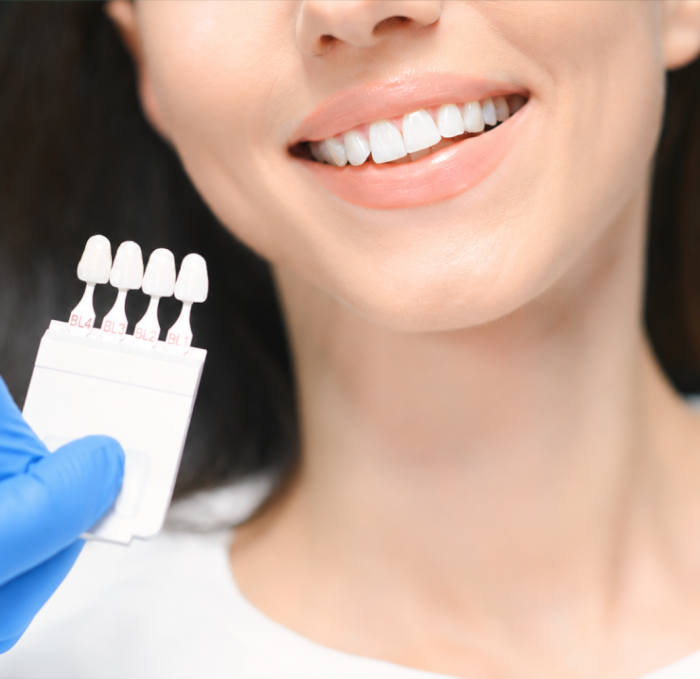 Blanqueamiento dental